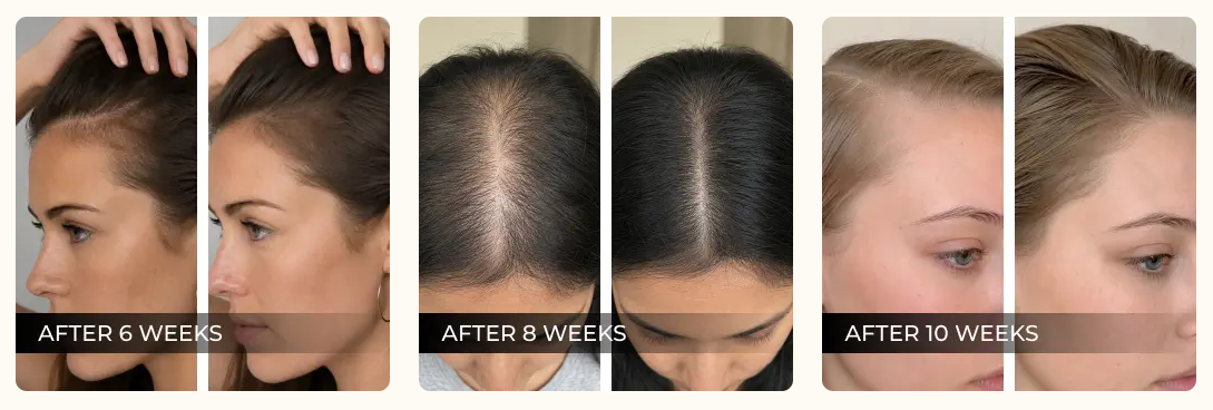 Rovay Red Light Brush Benefits